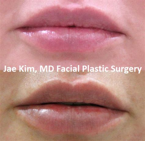 103 Lip Surgery doctors in Fairfax, VA 